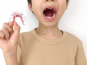 歯並びが悪くなる原因とは…?